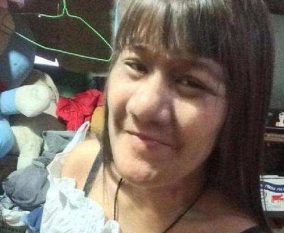 Dünyanın ən tüklü qızını bir də indi görün -  FOTOLAR